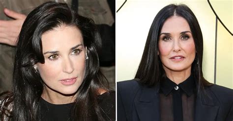 demi moore plastic surgery 2023.